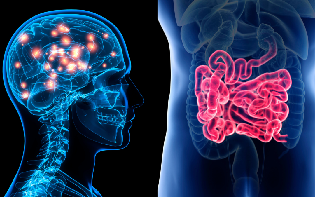 Stroke and Gut: There’s a Connection